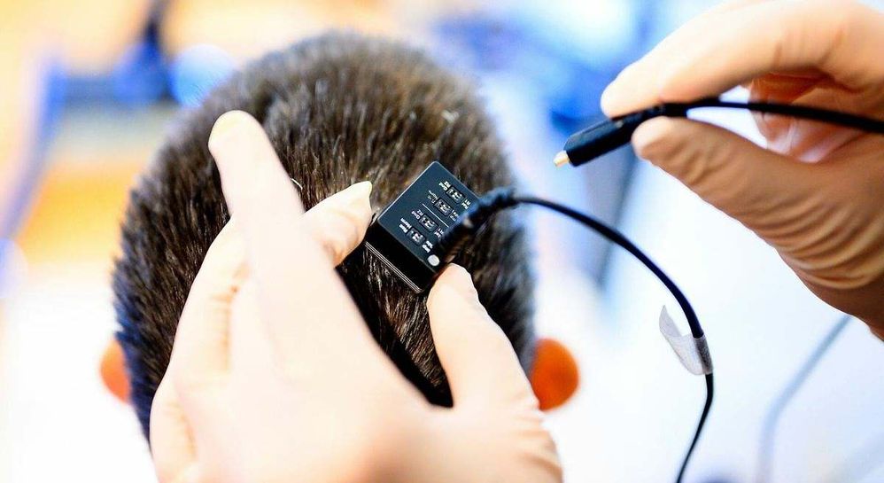 Noah Berger // Los investigadores conectan el implante cerebral de Ann al ordenador sintetizador de voz.